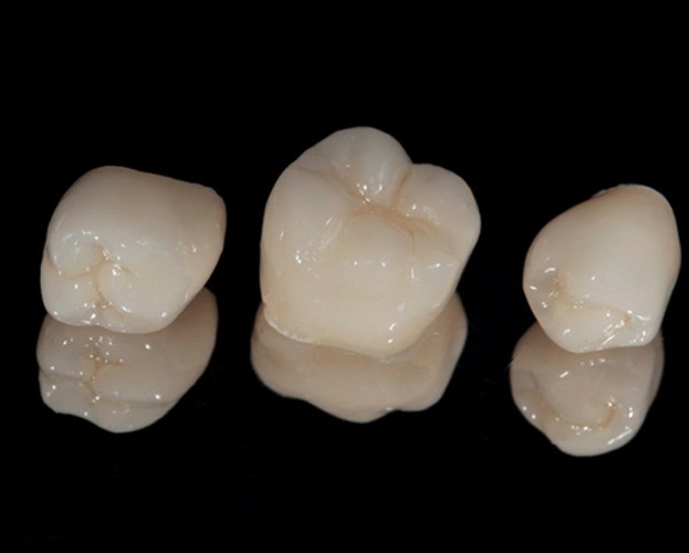 closeup of three dental crowns 
