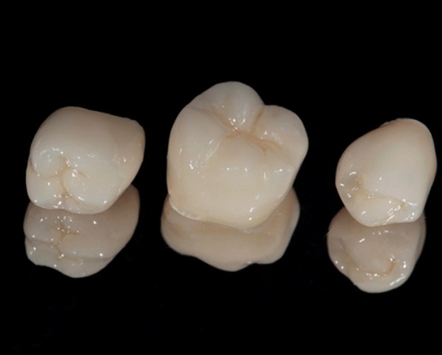 Close up of three dental crowns