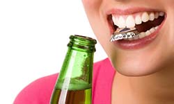 Woman headed for cracked tooth in West Seneca chewing on bottlecap