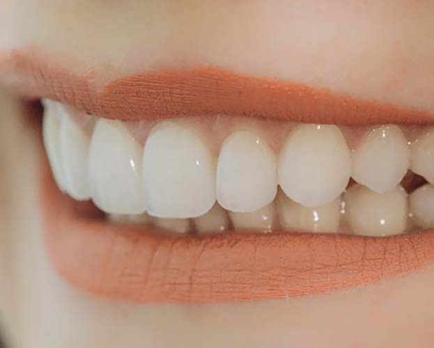 Close up of healthy smile after toothache treatment in West Seneca