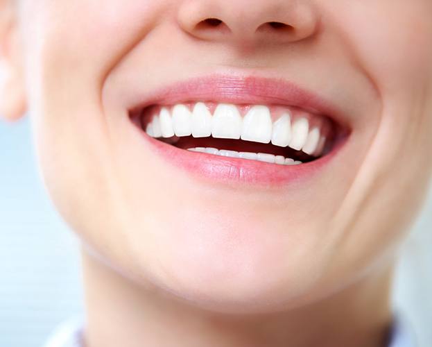 Closeup of smile after cosmetic gum contouring