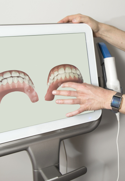 Digital images of teeth on computer screen in West Seneca dental office