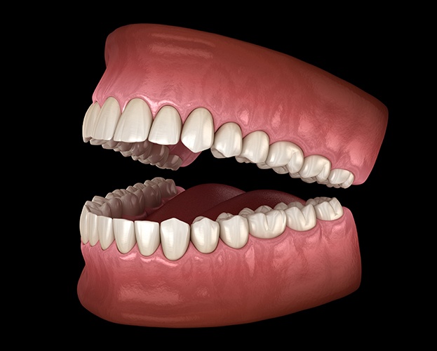 Animated full set of dentures