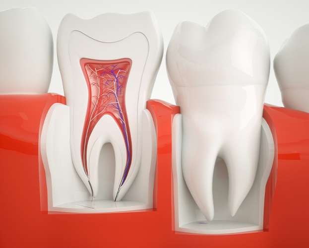 Animated inside of a tooth before root canal treatment