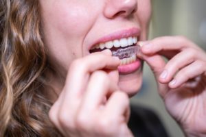 patient holding an aligner after preparing for Invisalign