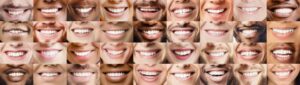 collage of individual smiles who had various cosmetic issues